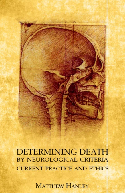 Determining-death